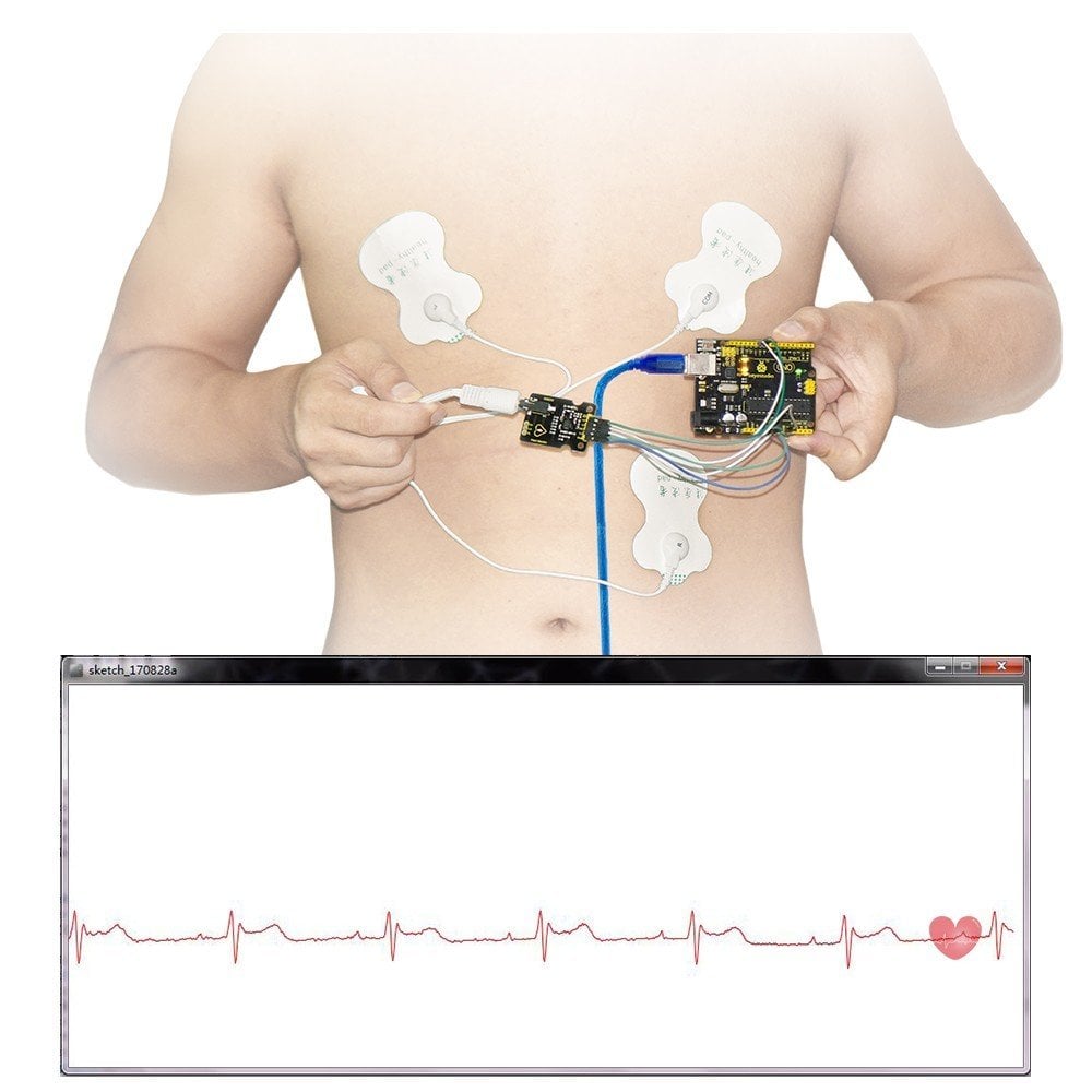 1 Keyestudio AD8232 EKG Ölçüm Kalp Monitörü Sensör Modülü / UNO R3 İçin - Görsel 1